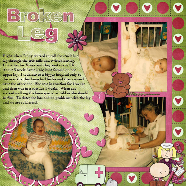 Broken Leg