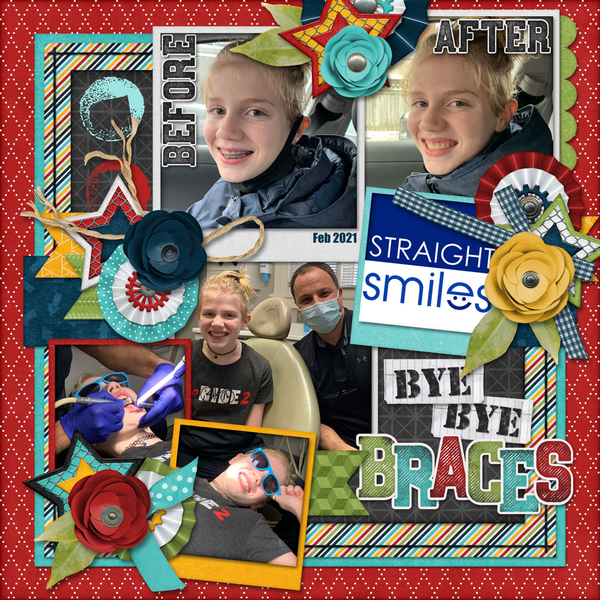 Bye bye braces