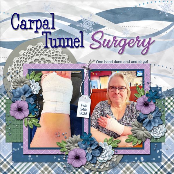 Carpal Tunnel Surgery