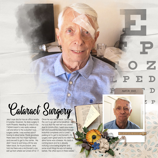 Cataract Surgery