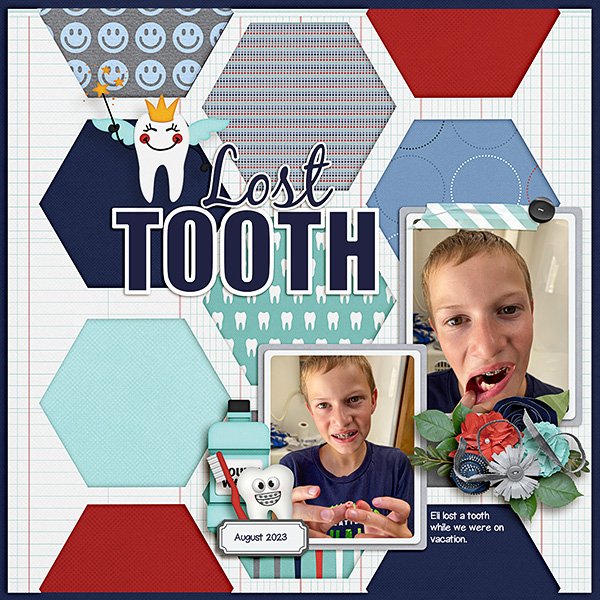 Eli-lost-tooth.jpg