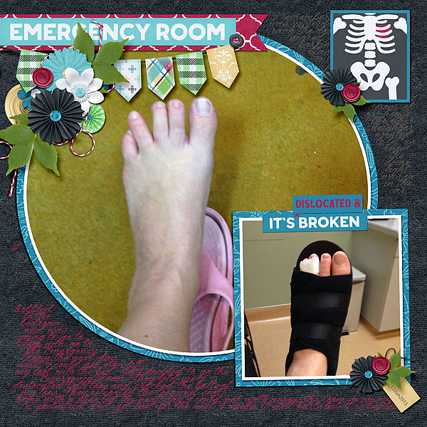 Emergency Room Its Dislocated and Broken