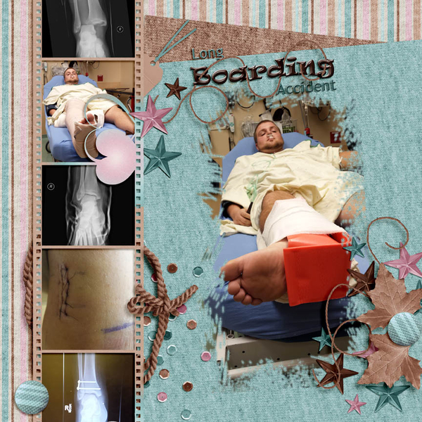 fxankle1