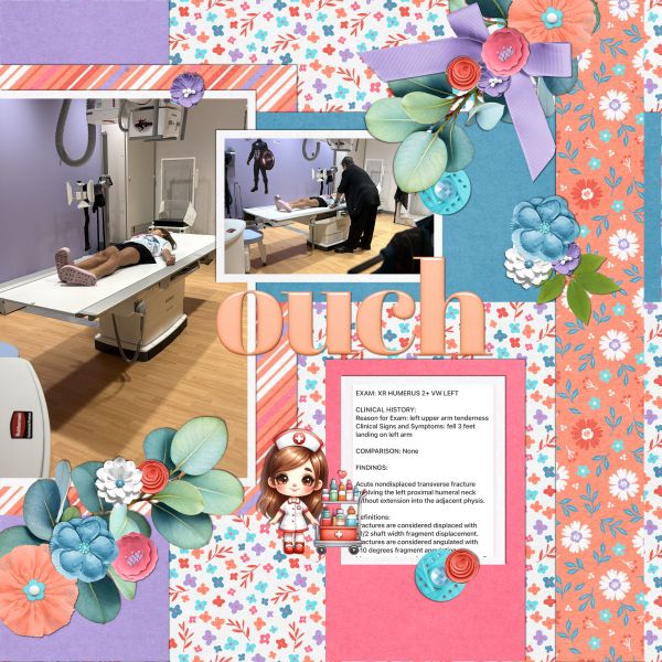 Kelsy - Arm Fracture