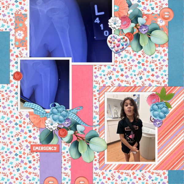 Kelsy - Arm Fracture