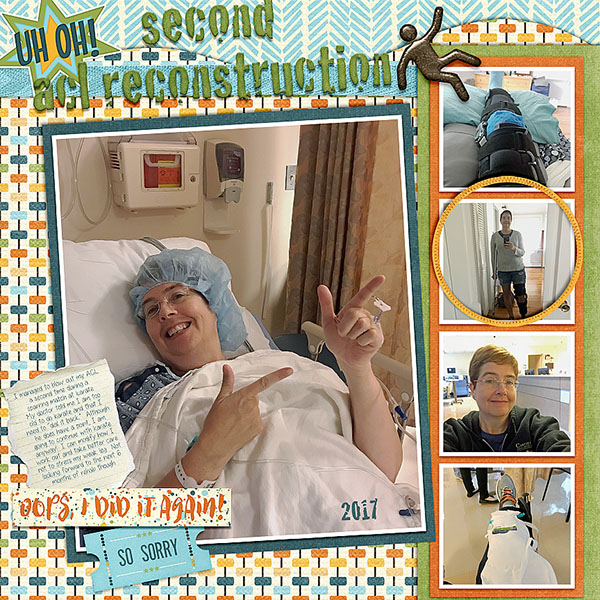 Knee Surgery 2017