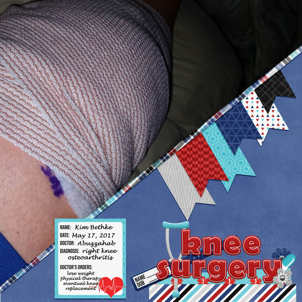 Knee Surgery