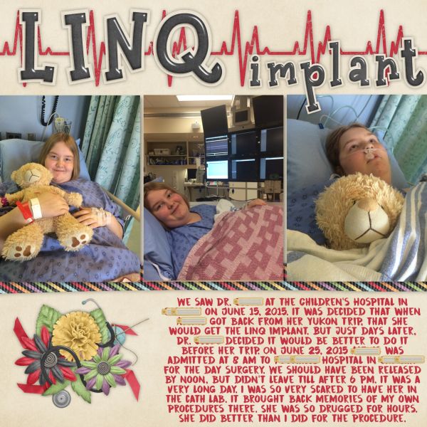 LINQ Implant