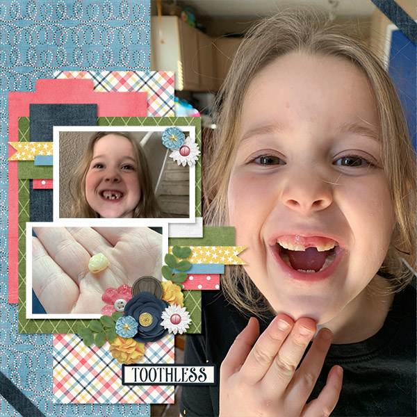 Lost Tooth