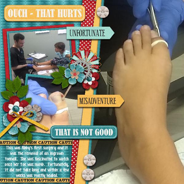 Oh No, My Toe!