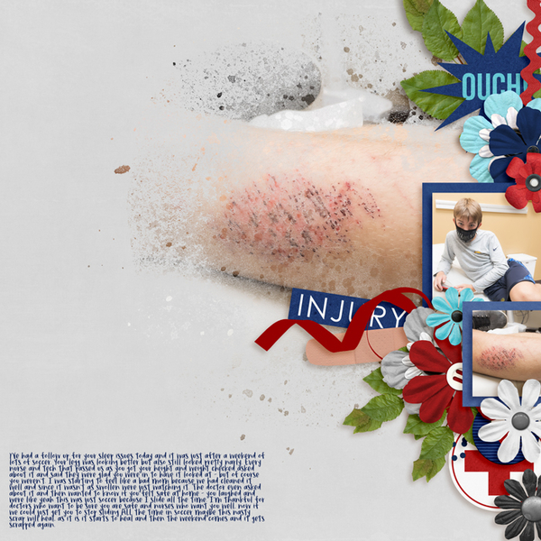 Sliding injury