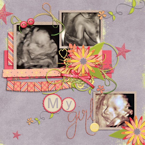 Sonogram- july 13