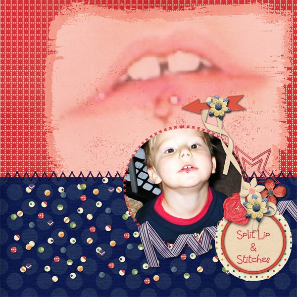Split Lip + Stitches