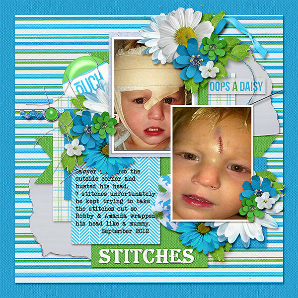 Stitches