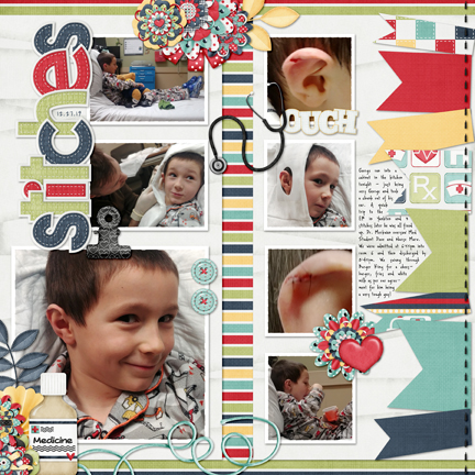Stitches