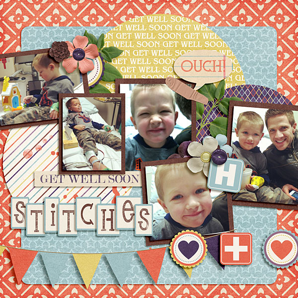 Stitches