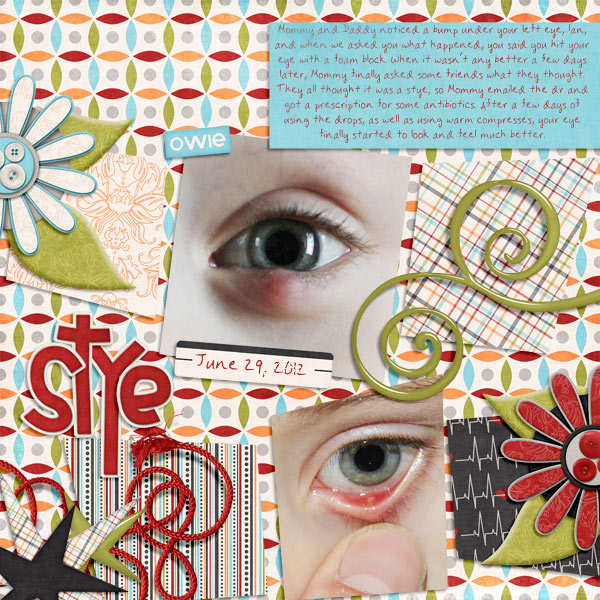 Stye