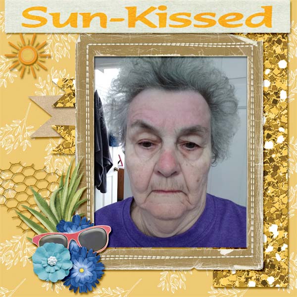 Sun Burn FAce