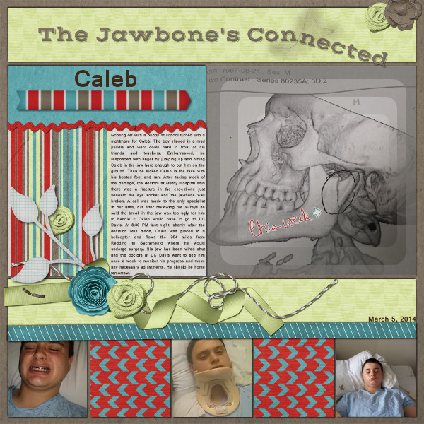 The Jawbone