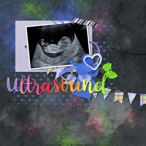 Ultrasound