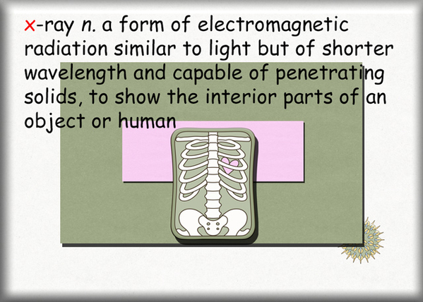 X is for X-Ray