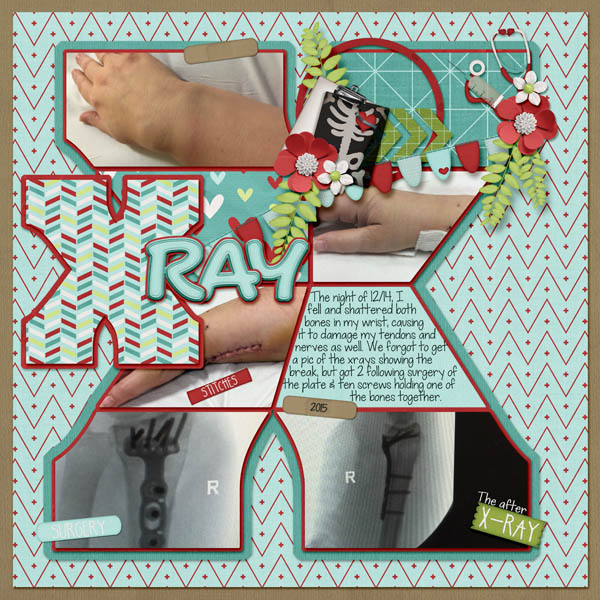 X-Ray